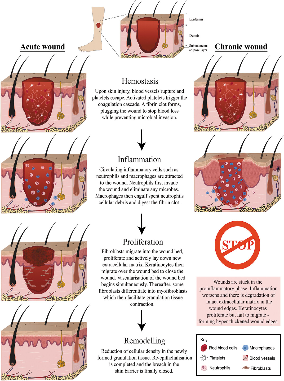 Healing stages